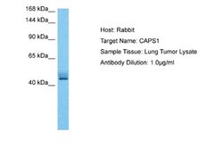 CADPS Antibody, Novus Biologicals 100 &mu;L | Buy Online | Novus Biologicals | Fisher Scientific